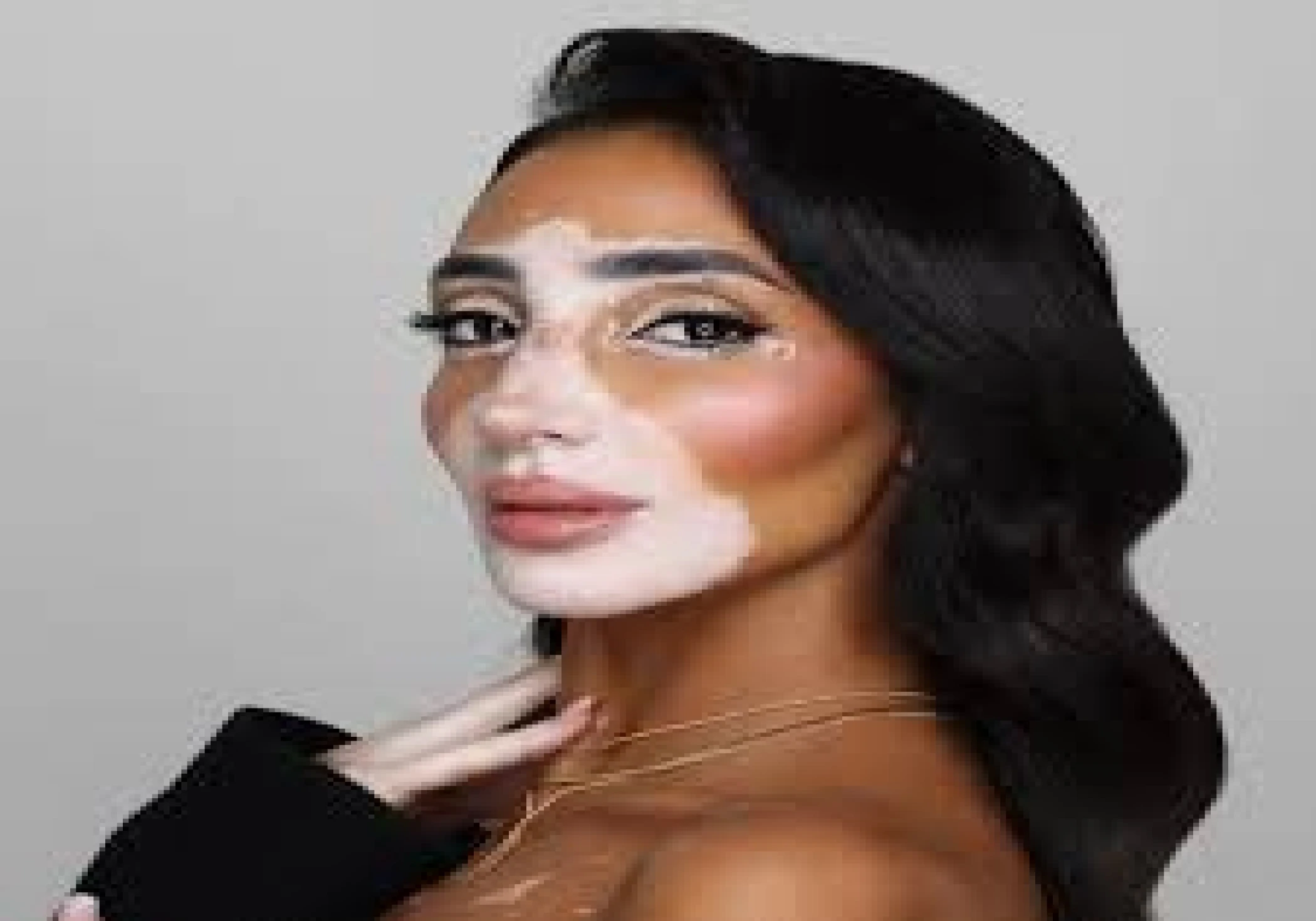 Logina Salah Makes History as First Miss Universe Contestant with Vitiligo, Redefining Beauty Standards