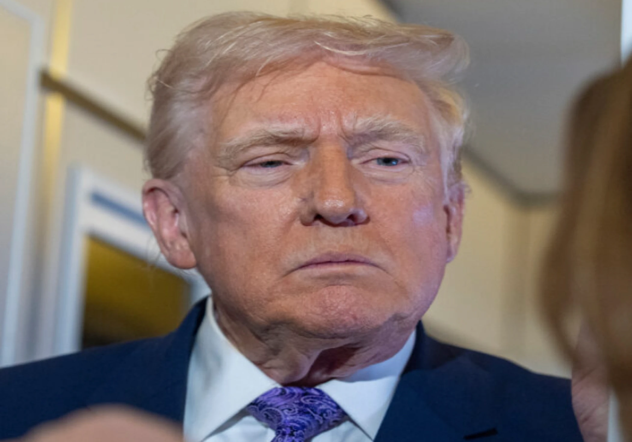 Trump Clarifies MRI Scan Amid Health Questions, Says He’ll Release Report