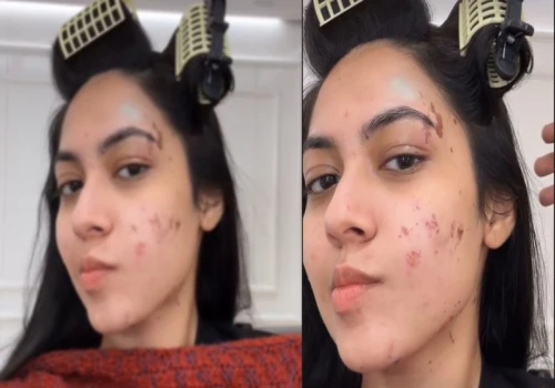 Reem Shaikh Injured in Cooking Accident on ‘Laughter Chefs’; Screams in Pain After Hot Oil Burn